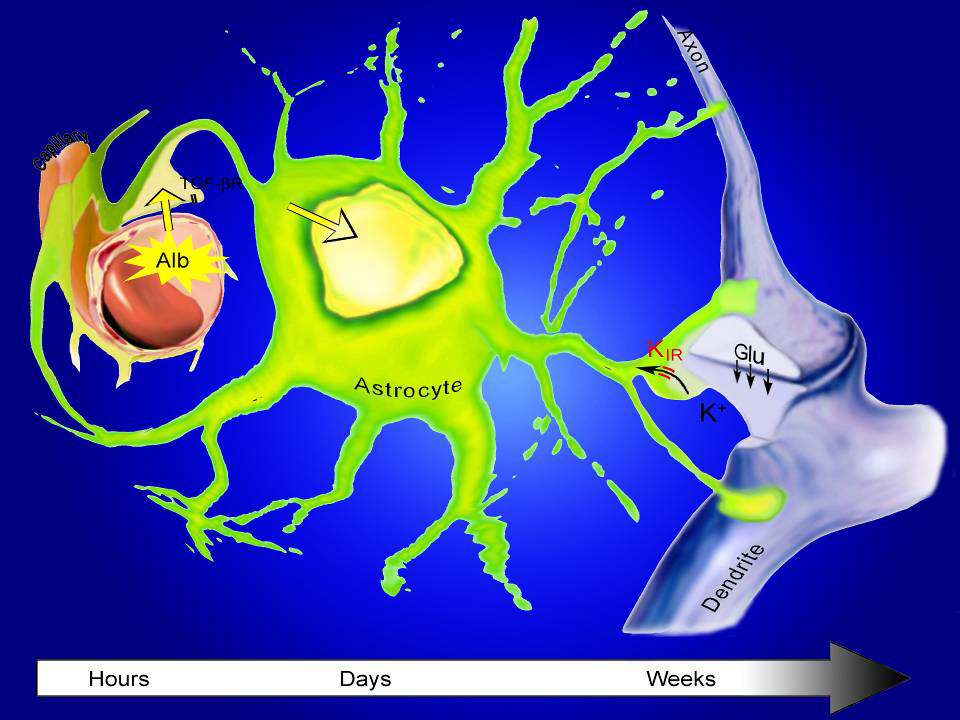 Within hours after the breakdown of the blood-brain barrier, the serum protein albumin gains access to brain cells. It binds to docking sites for the TGFBeta protein, located in neurons’ sister cells called astrocytes. This triggers changes in the astrocytes that ultimately overexcite neurons and can cause epilepsy.