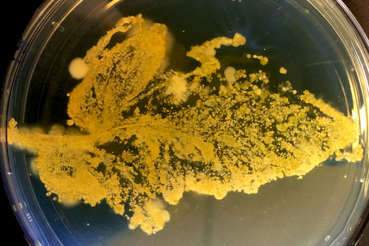 microbes from a leaf growing on an agar gel