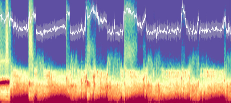 a three-color graphic of brain activity recorded by three frontal scalp EEG electrodes during a night of sleep. In white, the time-resolved spectral slope tracks the underlying changes in arousal level. 