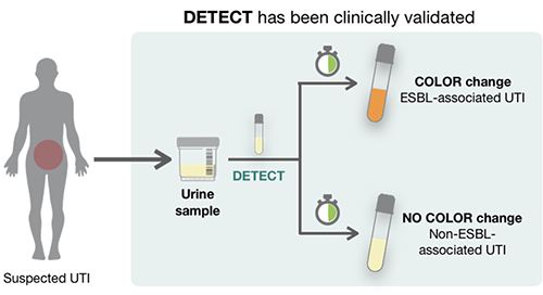 illustration of urine sample using DETECT to determine existence of ESBL