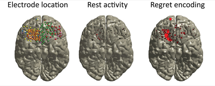 Image of brains with electrode location, rest activity and regret encoding.