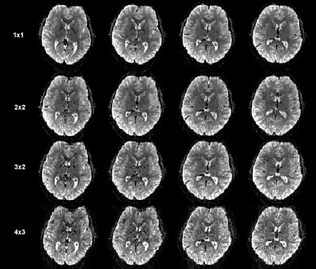 Four rows of brain scans.