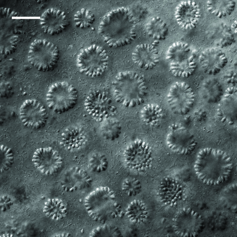 black and white microscope image of ring-shaped colonies