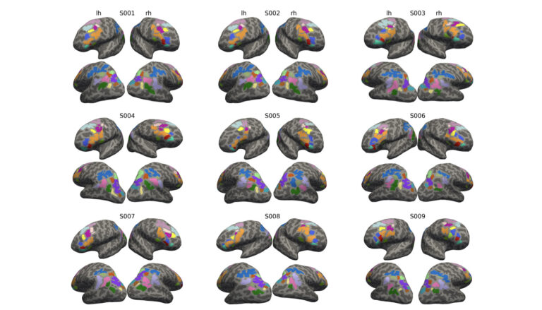 image of a bunch of MRI scans