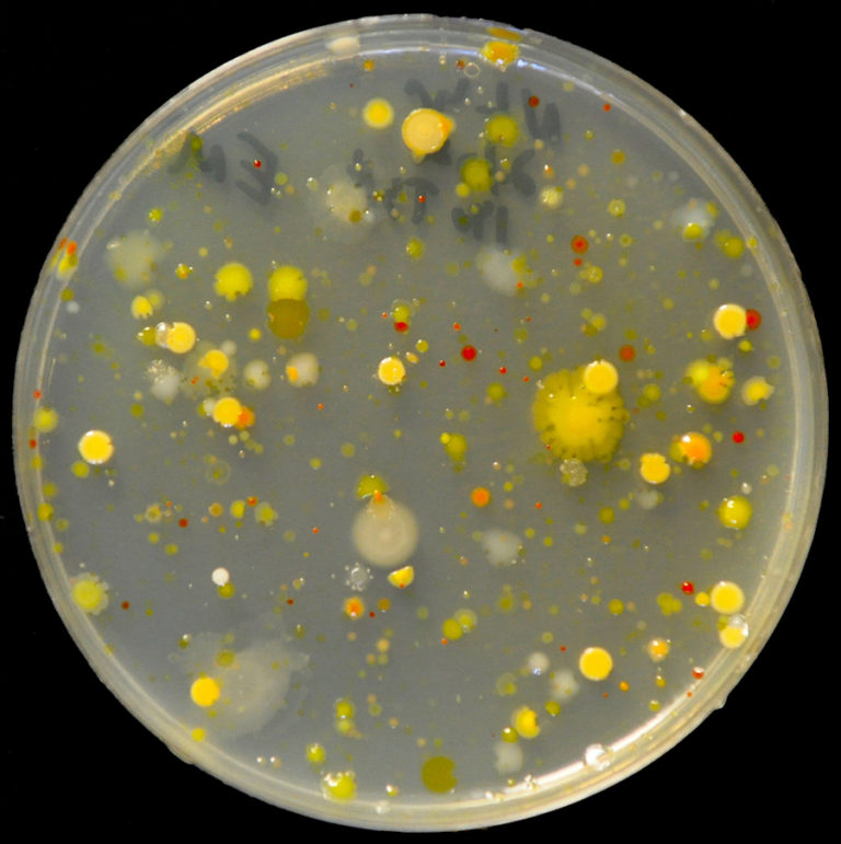 agar plate showing bacteria