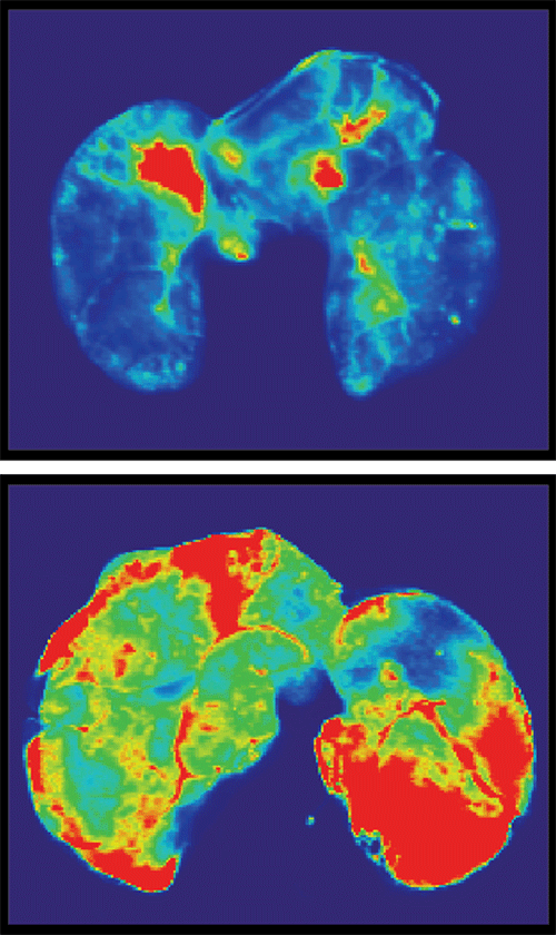 Two images show cross sections of lung tissue. The lower image, showing a lung that has been exposed to spike protein, shows considerably more red and orange than the upper lung image, indicating that the spike protein has triggered more vascular leak.
