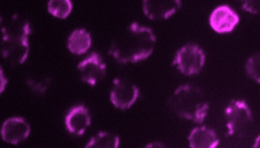 round purple things against a black background