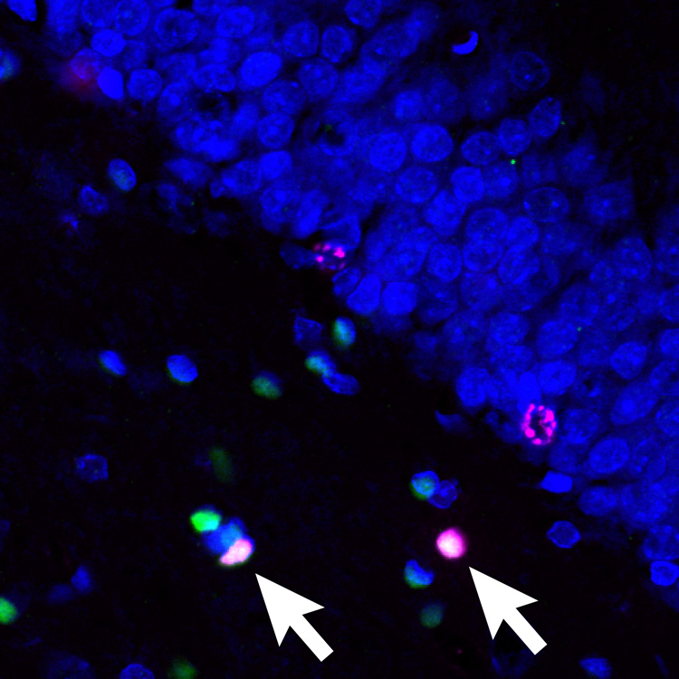 stained brain cells showing growth of new oligodendrocytes