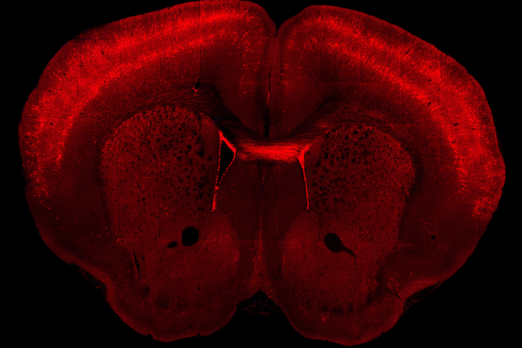 a cross-section of a mouse mouse brain, stained red to show the structure
