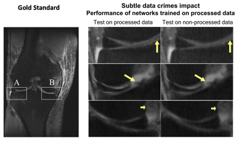 Comparison of medical images