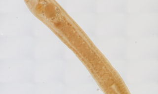 Schistorchis stenosoma