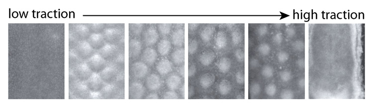 pattern of follicles