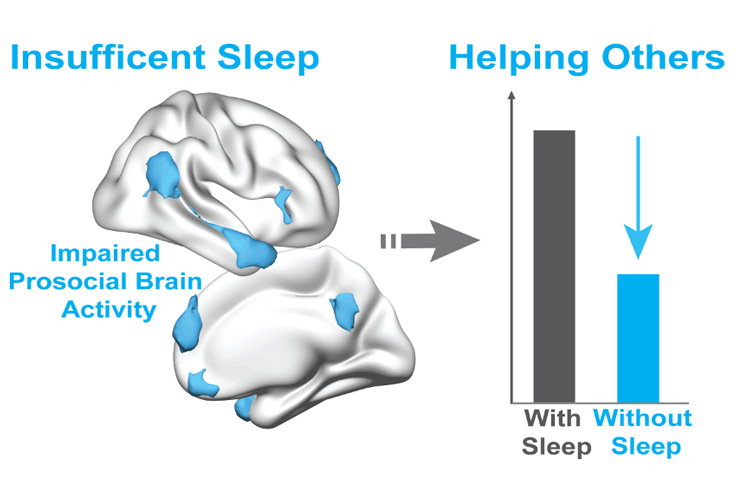 image of brain illustrating how lack of sleep affects specific regions involved in desire to help others