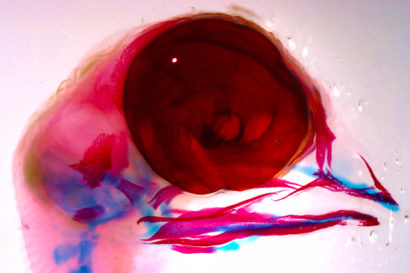 chick embryos were stained blue and red 