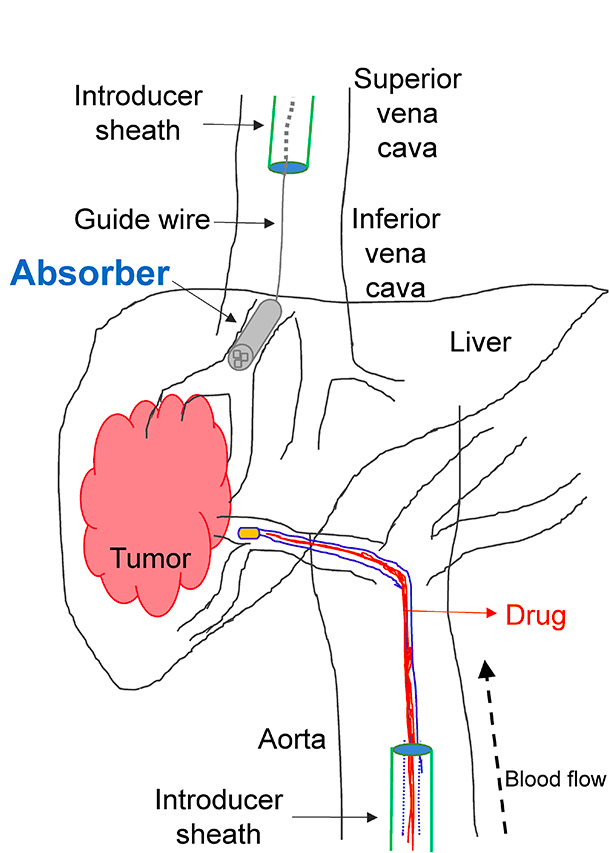 graphic showing absorber