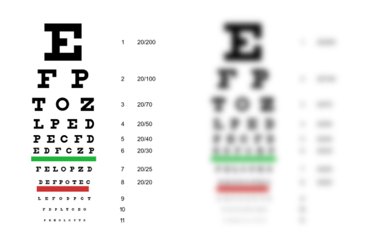 vision charts illustrating good and poor vision