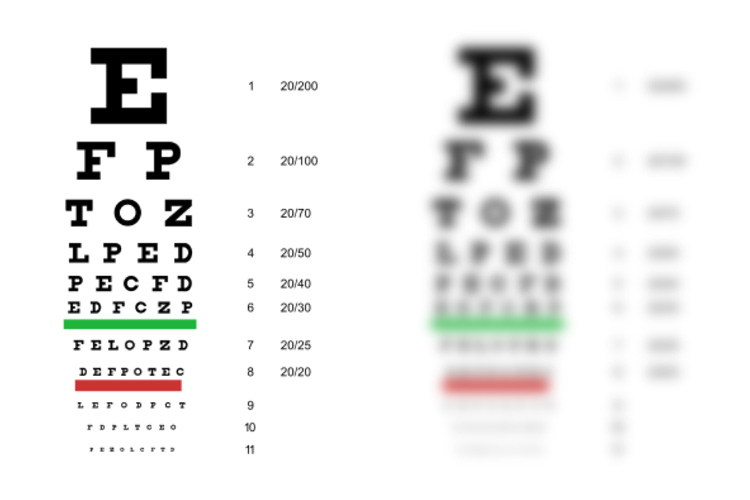 What does 20/25 vision mean? Is it better or worse than 20/20?