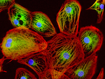 Human cardiac myocytes stained (in green) for proteins encoded by edited genes using the new CRISPR/CAS9 technology.