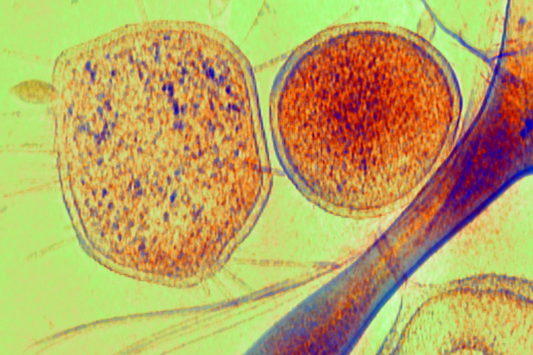 tiny cells with tiny CRISPR systems