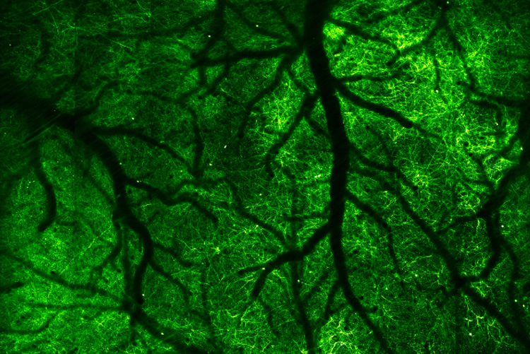 nerve cells in the brain