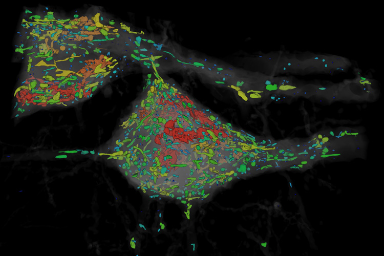 colored organelles inside a mouse neuron