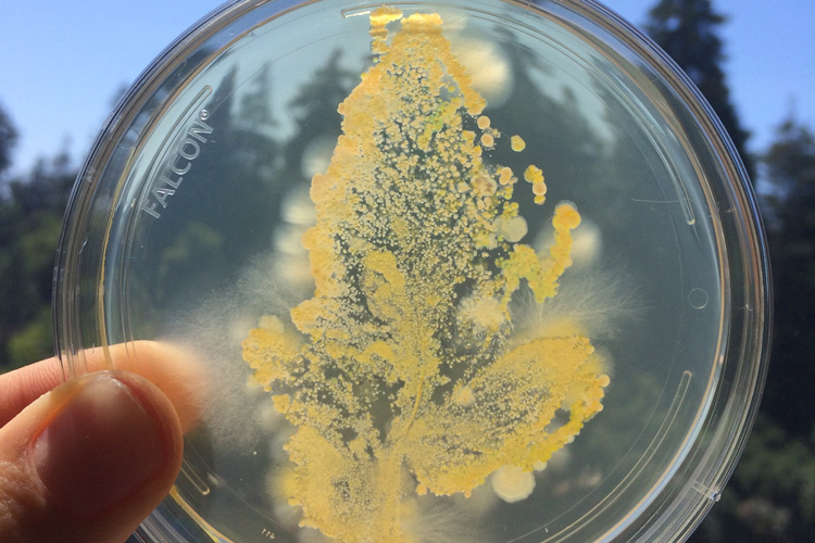 petri dish with microbes