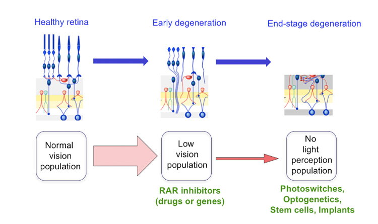 Retina - Gene Vision