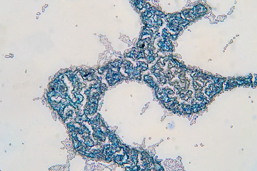 Saccharomyces cerevisiae, also known as brewer’s yeast, has been dyed blue to be seen under a microscope. 