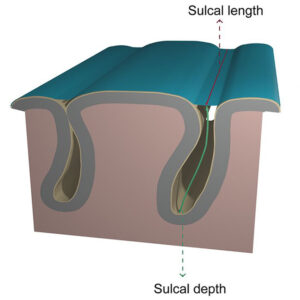 cross sectional drawing of the sulcus of a brain, showing the deep groove