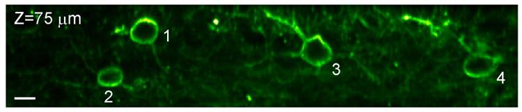 spontaneous firing of neurons in the mouse brain