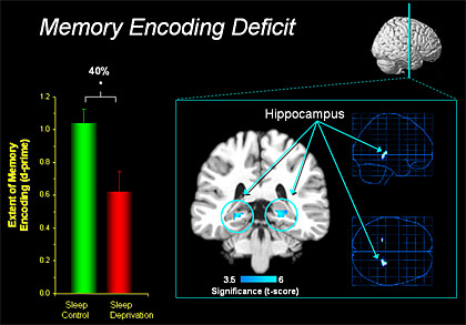 Diagram of the hippocampus and a chart comparing sleep deprivation to memory encoding.