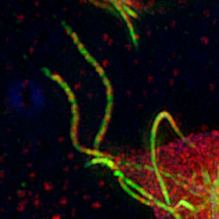 Flagella of Giardia parasite imaged at Super-Resolution.