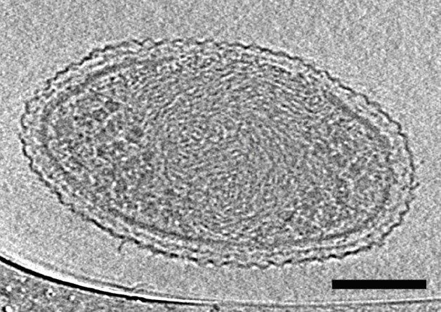 Internal structure of an ultra-small bacteria cell.