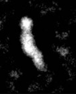 a negative image of a protein.
