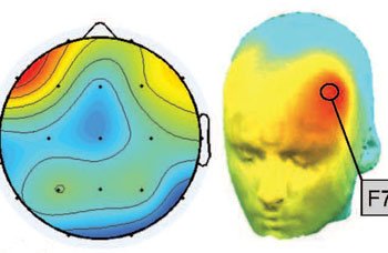 Heat maps of a brain .