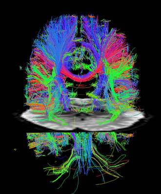 bright Colored lines representing nerves in a brain.