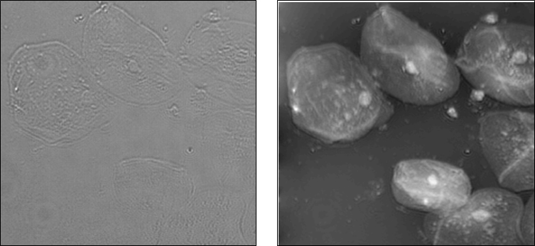 Computational imaging reveals cell structures (right) that are invisible to conventional optical microscopes (left).