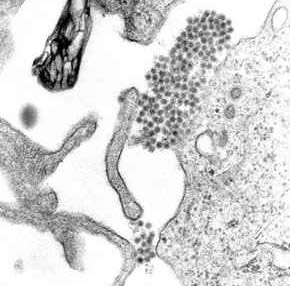 microscopic image of dengue virus.