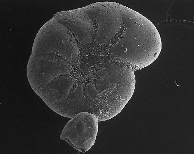 Microscopic foraminifera.