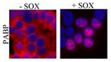 the protein illuminated in blue and purple.