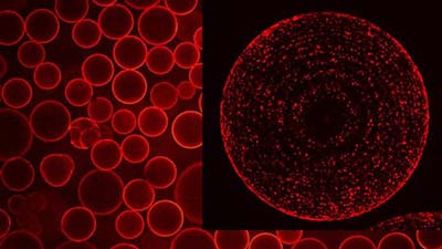 Fluorescence micrograph of affinity beads coated with organelles known as lysosomes. 