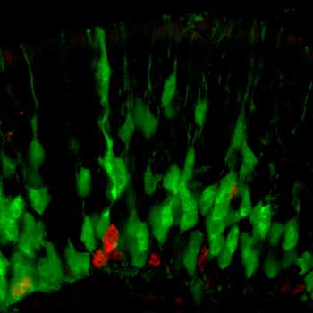 A cluster of green cells and three red ones.