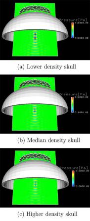 three images of the skull, one at low density, one at median density, and one at higher density.