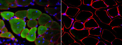 Luminescence of muscle cells.