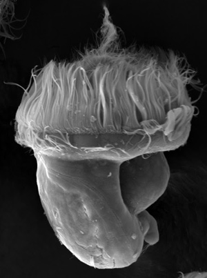 Microscopic image of leech