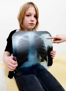 Stock photo of a young boy holding up an X-ray of his sternum.