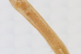 Schistorchis stenosoma