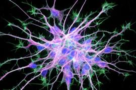 cytoskeleton of neuron