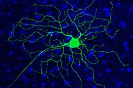 a green ganglion cell stands out agains a sea of blue retinal cells