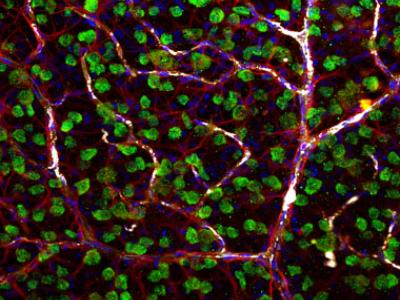 Retinal ganglion cells, astrocytes, and blood cells